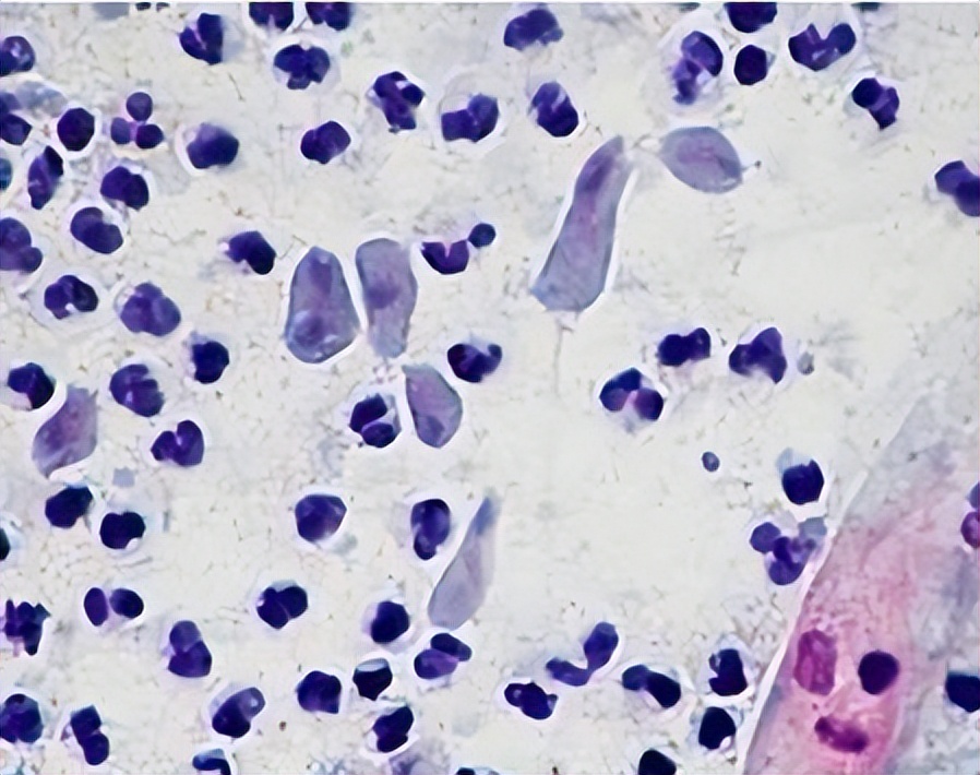 2块钱一袋的甲硝唑有副作用吗,几块钱一瓶的甲硝唑有什么作用