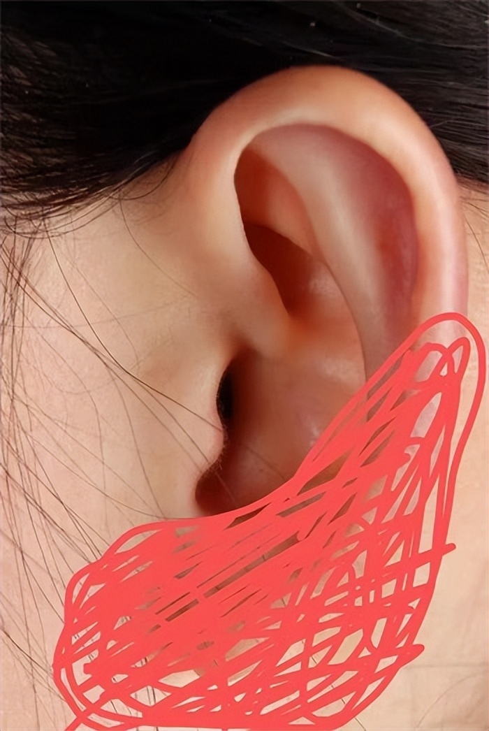 00后打耳洞,00后女生打耳洞感染