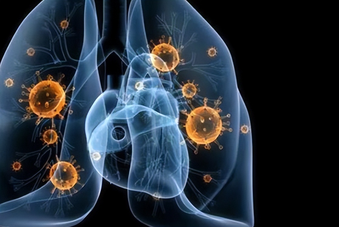 艾滋病的口腔症状有哪些？不妨查看自己是否有这3个“迹象”