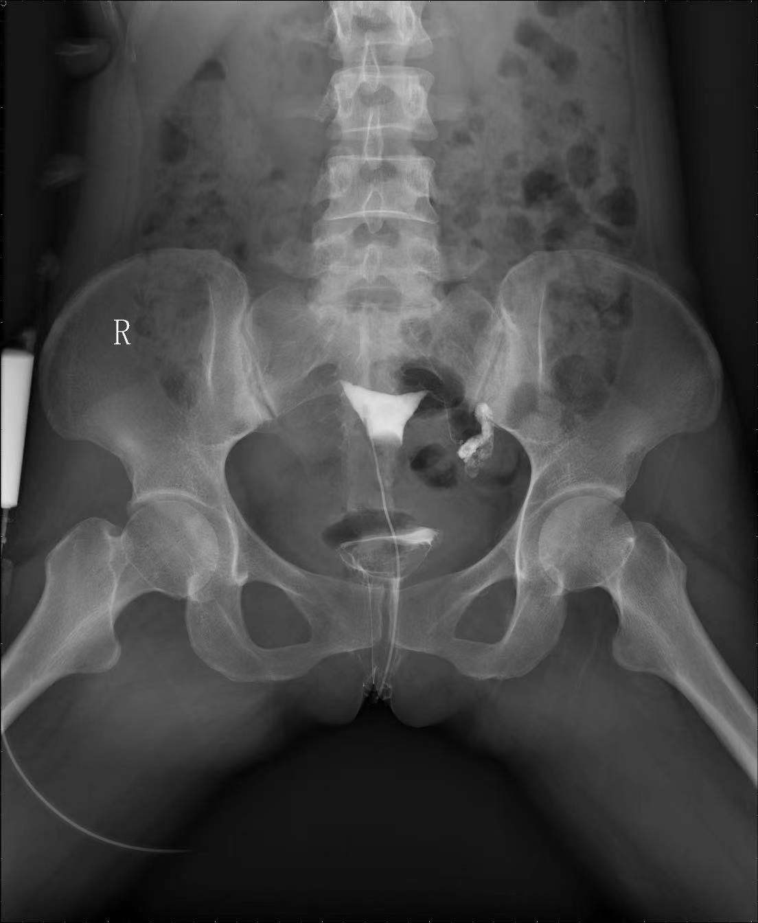 河池市罗城仫佬族自治县人民医院,罗城仫佬族自治县人民医院内二科