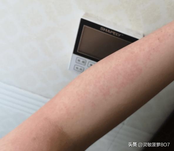 用过两三次脱毛膏会不会致癌,千山暮雪脱毛膏有致癌风险吗