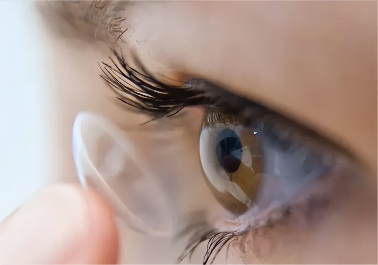 眼科集采政策利好还是利空,广西眼科晶体集采最新消息