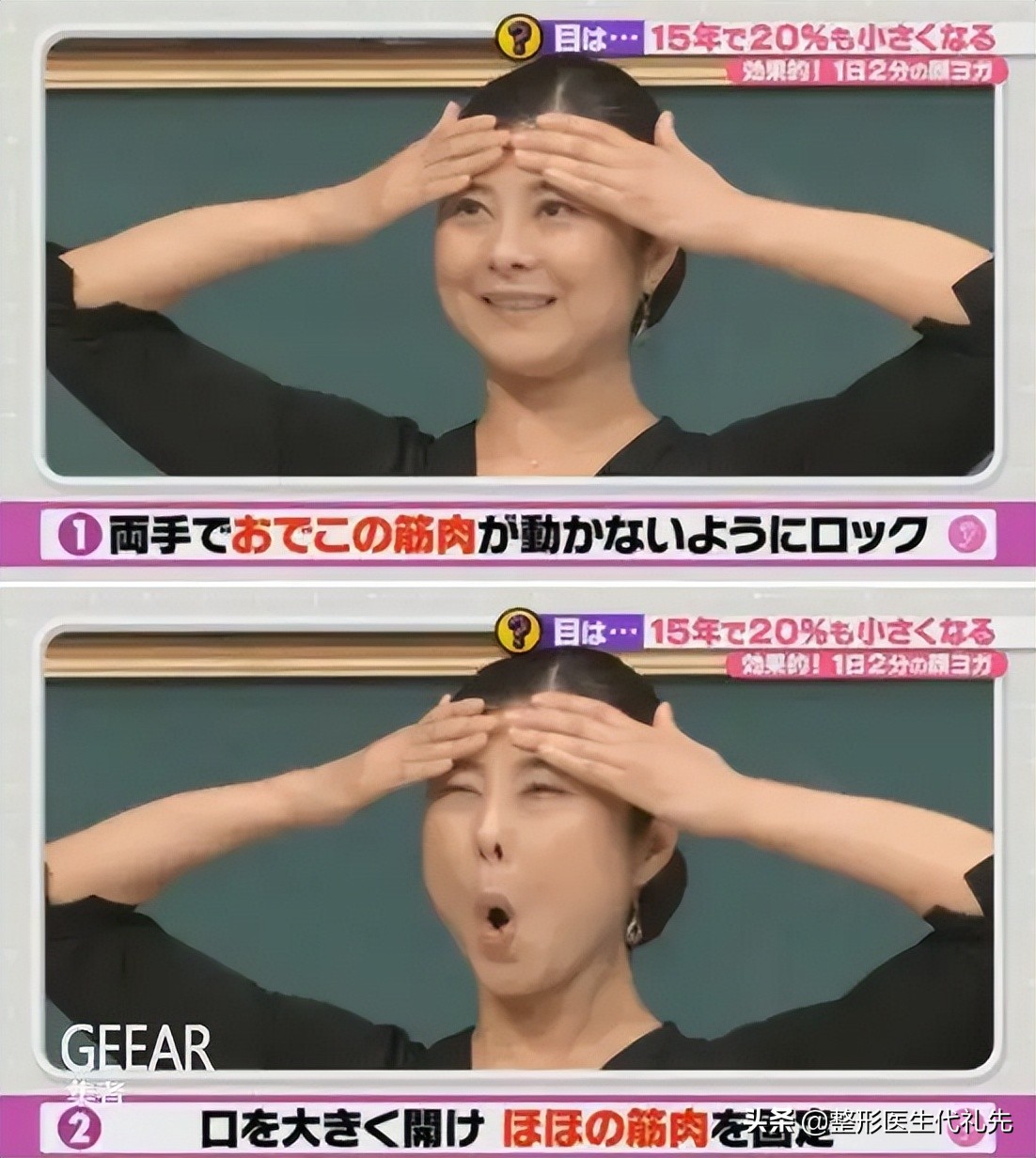 40岁以后为什么眼睛变小了,年轻人眼睛变小了怎么回事