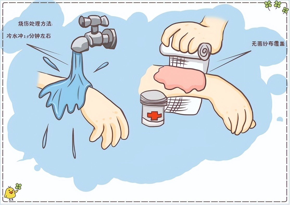 烧伤患者创面处理,烧伤创面处理的原则主要是