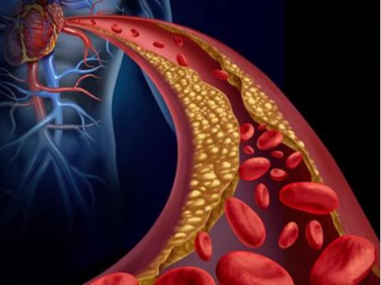 保健药辅酶q10对心脏病真的有效吗,辅酶q10对心脏病真有用吗