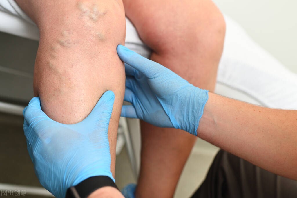 63岁老人身体有点浮肿,80岁老人全身浮肿没食欲浑身无力