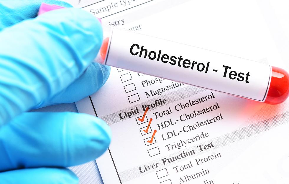 体检一般检查哪些项目中老年女性,中老年人体检要做哪几项检查