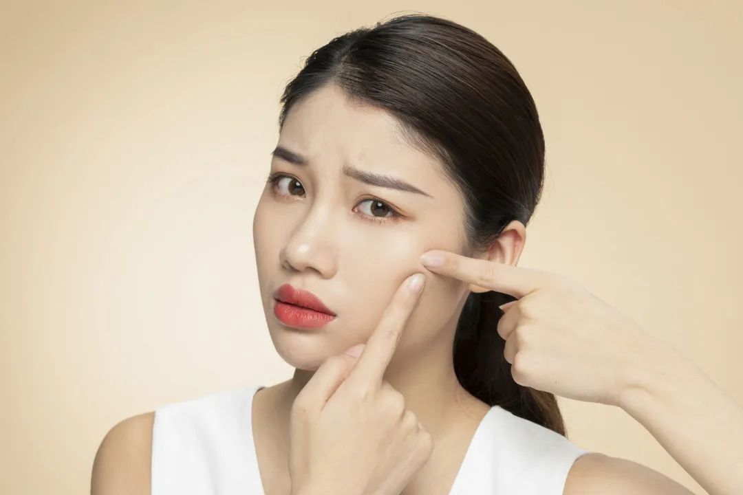 便秘长痘怎么调理,便秘会长痘是什么原因