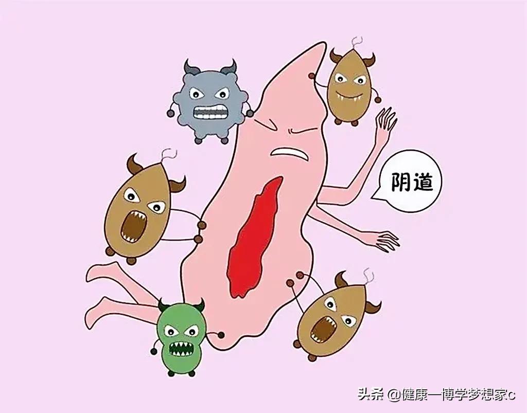 外阴瘙痒分几级？都有哪些原因？该如何护理？