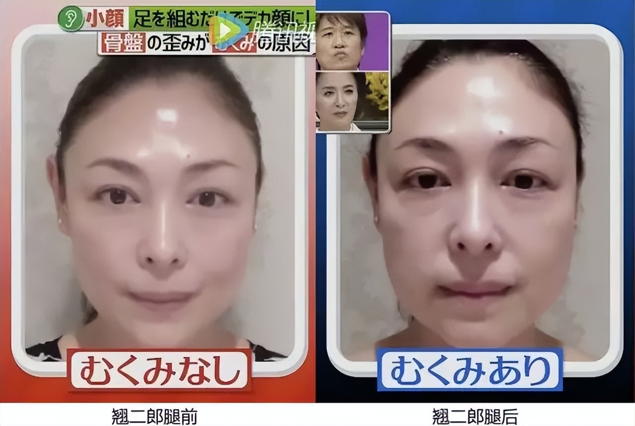 为什么体态比颜值重要,常见的9大不良体态问题