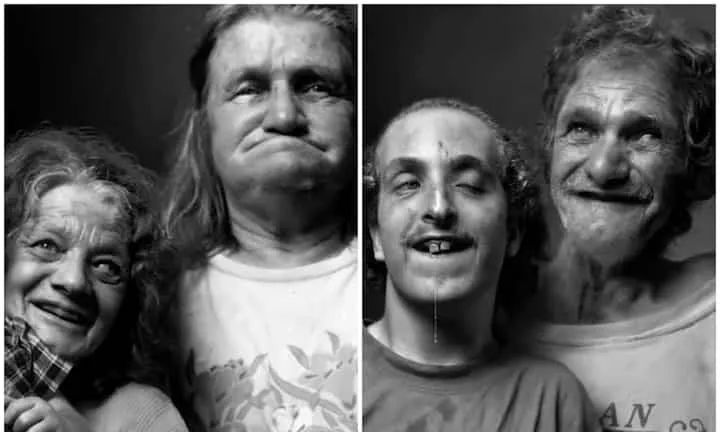 美国家族*伦乱**三代：*亲近**结合导致后代残障，无法说话只能犬吠