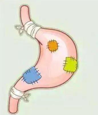 烧心心下痞能用半夏泻心汤吗,烧心胃胀泻心汤