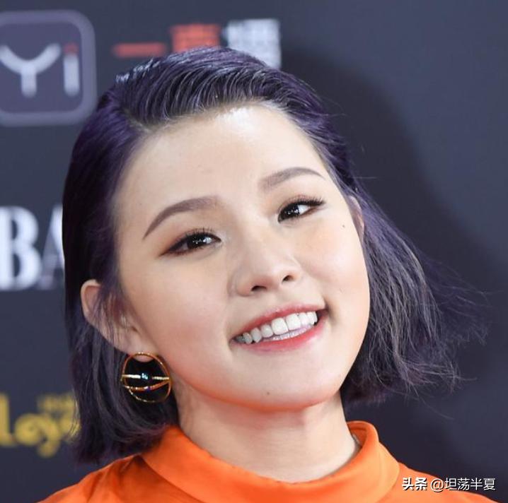 那些整容失败的女星你还记得哪些,盘点整容失败惨不忍睹女星