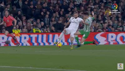 本泽马绷带打手腕,本泽马的右手金色绷带