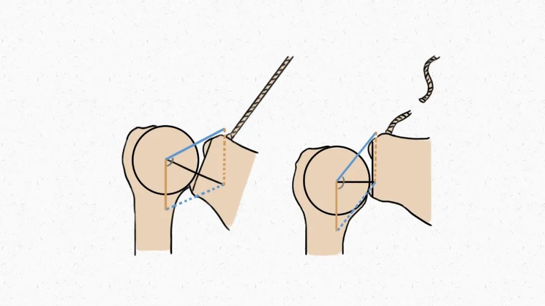 赶紧停下！火爆全网的这种身材，华西医生说：一不小心就让你受伤