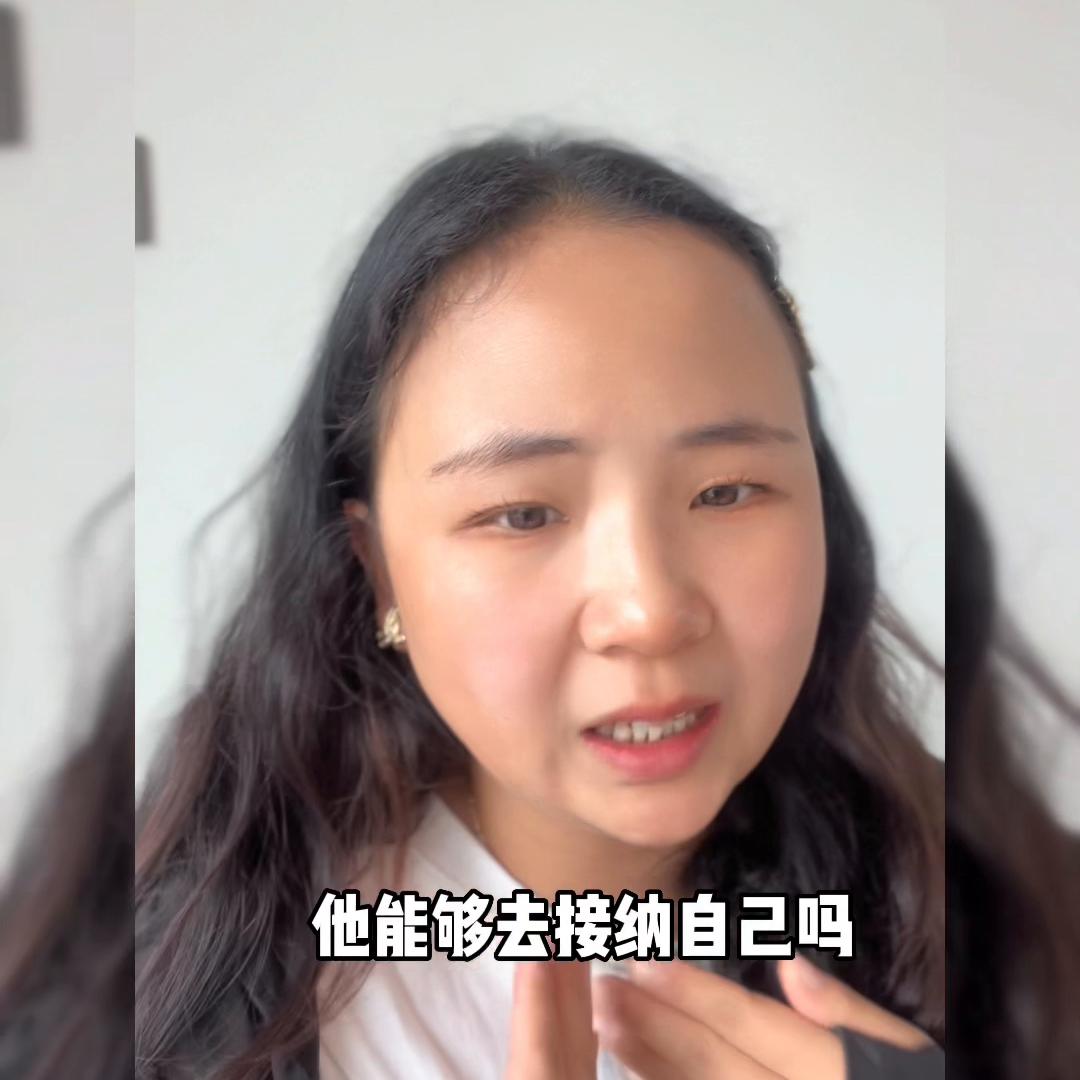 忽然被扇巴掌怎么处理,突然扇自己巴掌