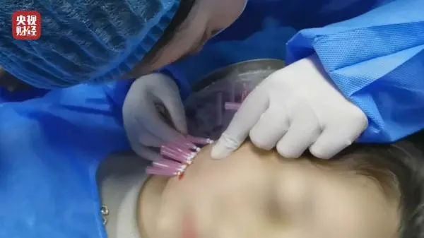 针尖上的黑医美，比脚尖上的酸菜还恐怖