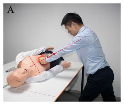 腹部提压心肺复苏术有用吗,腹部提压心肺复苏和胸外心脏按压