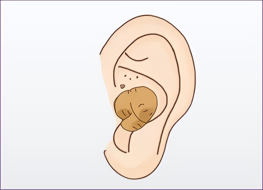 宝宝老是挠耳朵揉眼睛是怎么回事,宝宝总是抓耳挠腮揉鼻子怎么回事