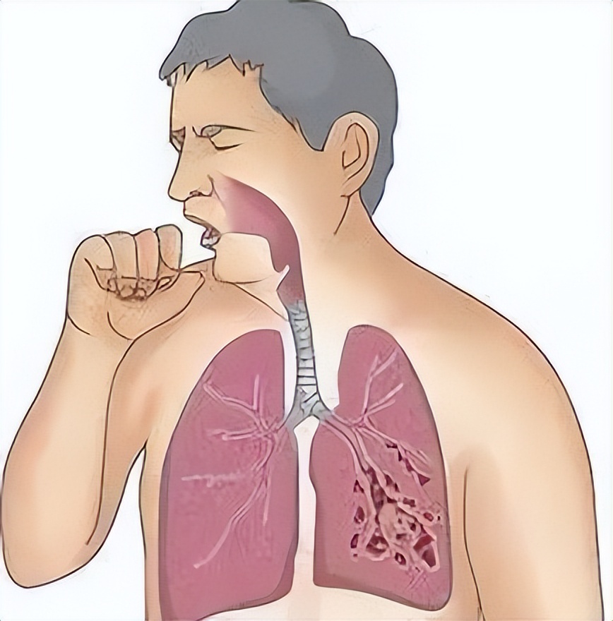 肝郁脾虚痰瘀互结证吃什么中成药,肝郁有痰咳嗽肝肾阴虚