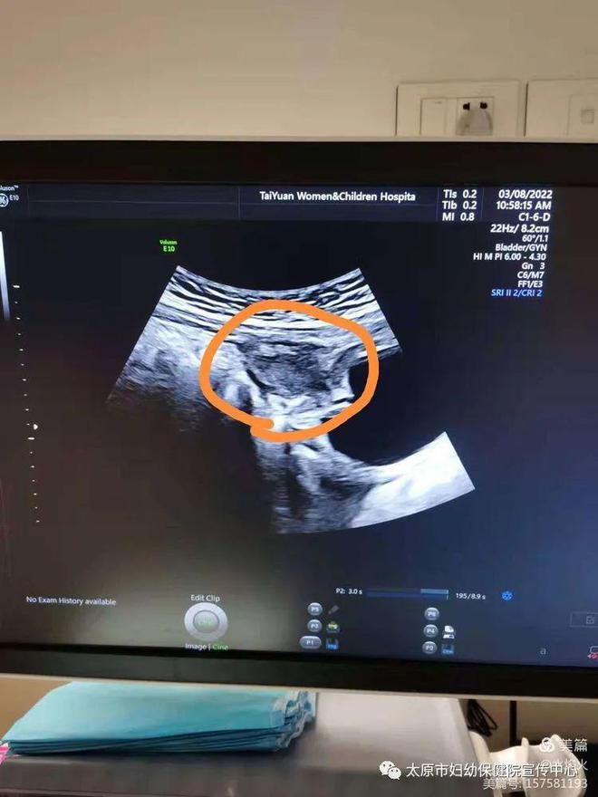 太原最新妇幼保健院,太原市妇幼最新消息