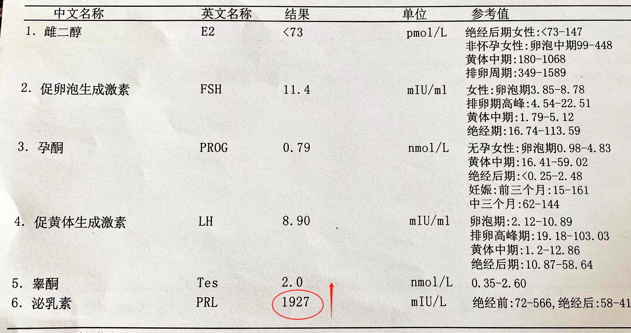 高泌乳素血症月经正常需要治疗吗,高泌乳素血症导致月经不调怎么办
