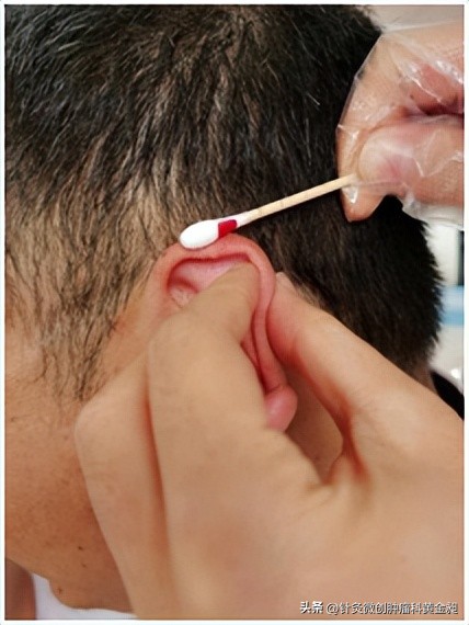 颈部淋巴结节消除的药,颈部淋巴结肿大不消除