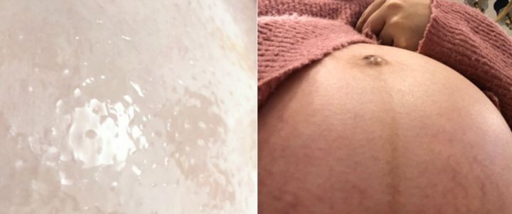 产后淡化妊娠纹品牌排行榜,产后妊娠纹霜全球排行榜