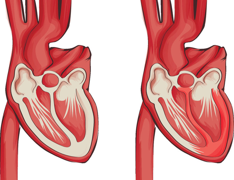 生气过度会引起的中毒,一次生气可能会诱发7种身体疾病