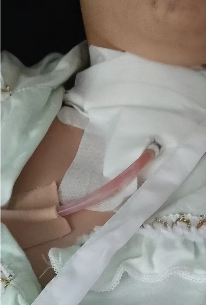 甲状腺癌教师资格证体检能过吗,抗癌日记忠告要体检