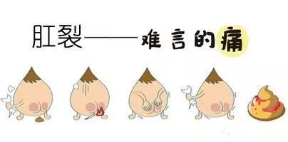 慢性轻微肛裂不想手术,轻微肛裂不流血就是疼