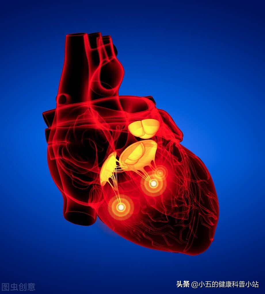 活血化瘀冠心病,冠心病人能吃心脑宁胶囊吗