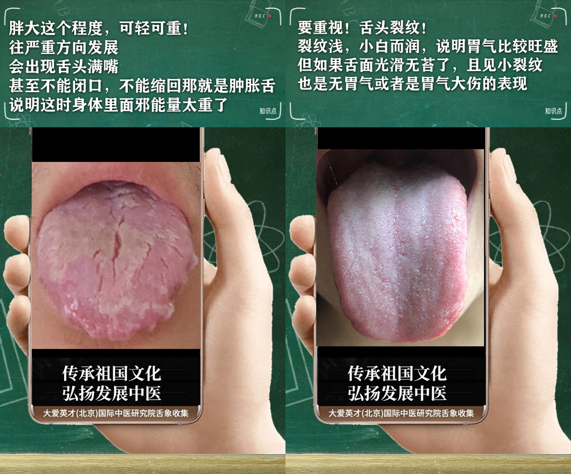 嗜睡肢冷鼻塞中医辨证,中医讲解感冒手脚冰凉