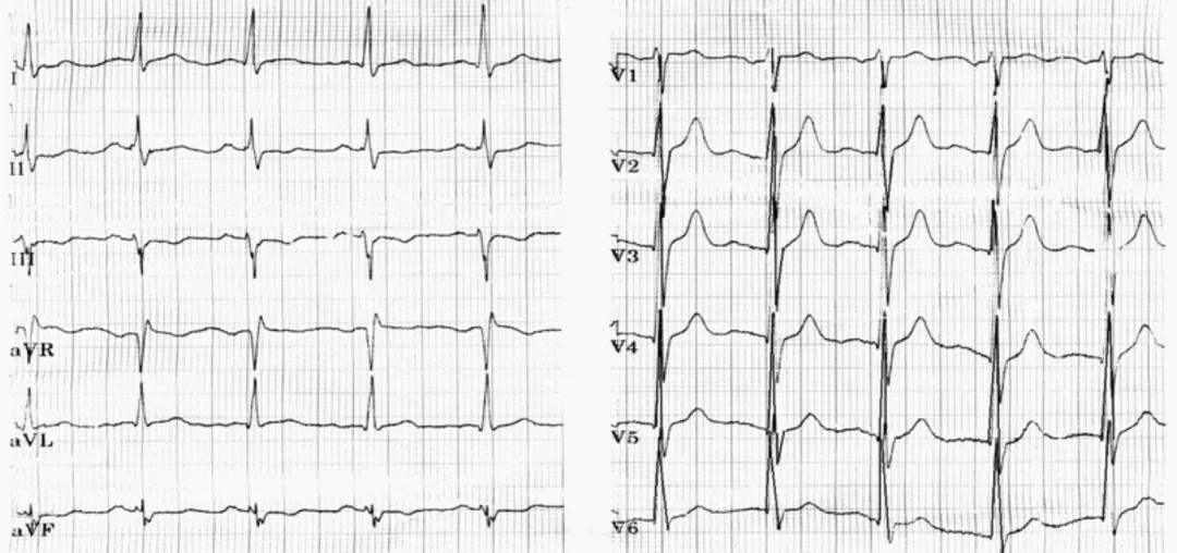 心绞痛不是忍忍就能过去的，及时诊治才是正确的做法