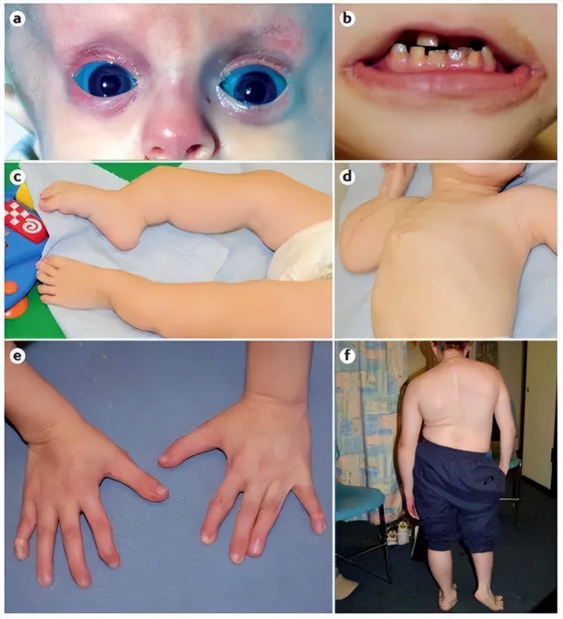 骨折30年被人当“*子骗**”,只因帮深圳这香港医生说了一句话