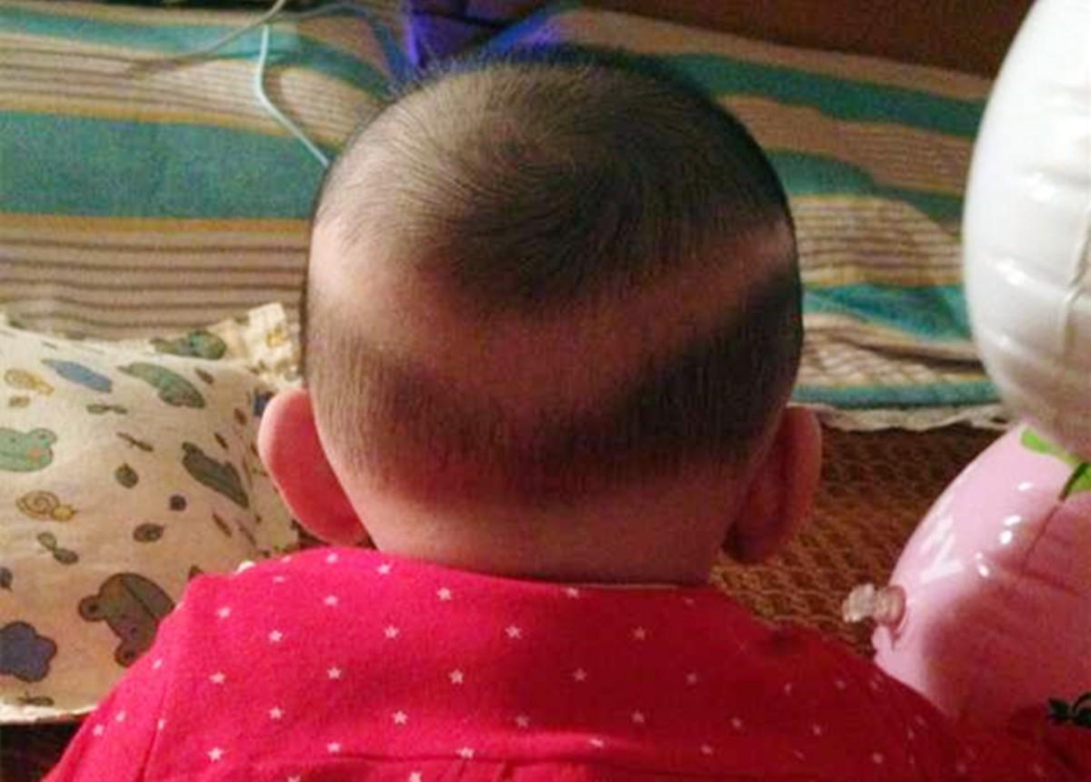 宝宝枕秃就是因为缺钙了是真的吗,宝宝有枕秃就是因为缺钙吗