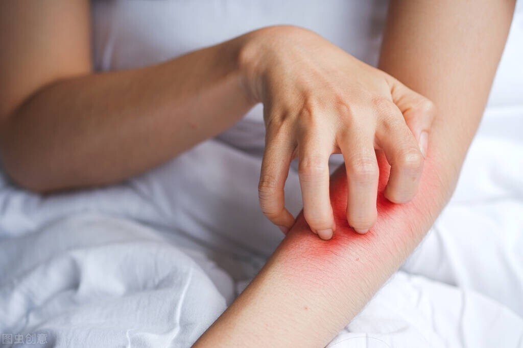 被蚊子咬了口水止痒有用吗,蚊子包涂口水有什么危害