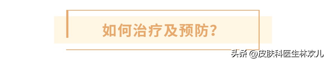 【日光性皮炎攻略】夏天想去海滩晒阳光浴？教你如何保护好自己！