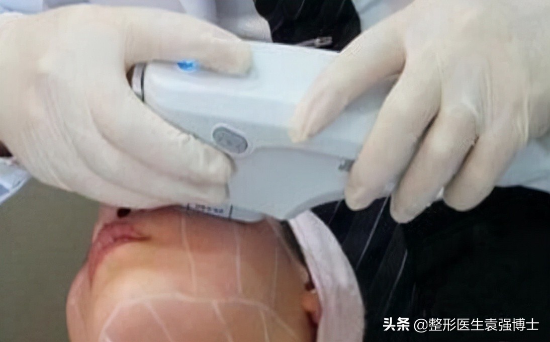 40岁面部皮肤松弛怎么紧致,40岁脸部松弛锻炼可以改善吗