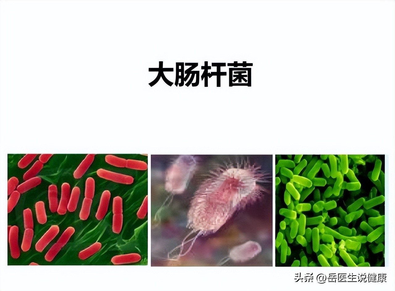 尿路感染用哪种抗生素好得快,尿路感染严重时是不是常用抗生素