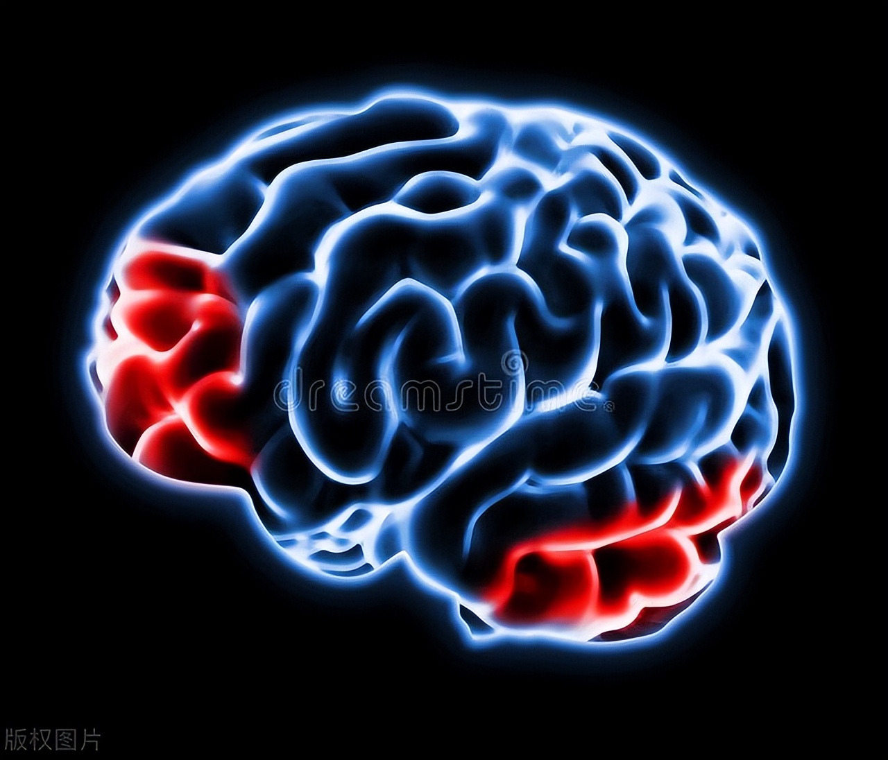 脑死亡还有存活的希望吗,脑死亡是否有可能生存