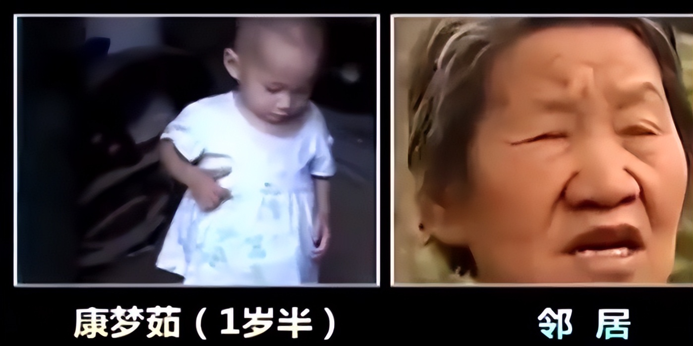 女童肚子超大疑似怀孕,2岁女婴肚中发现“胎儿”