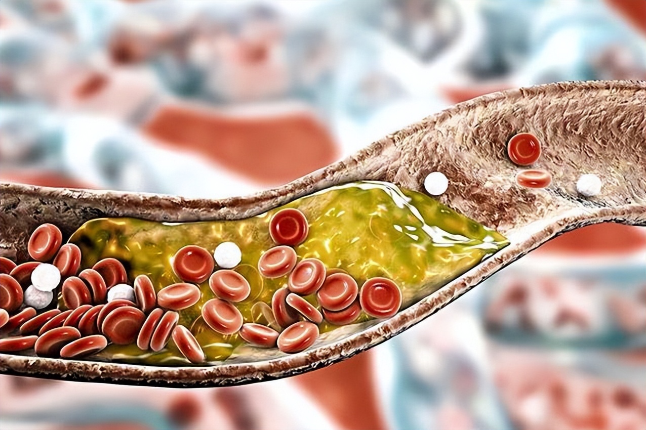 阿托伐他汀,进口药比国产药贵10倍，疗效差别真的很大吗?涨知识了