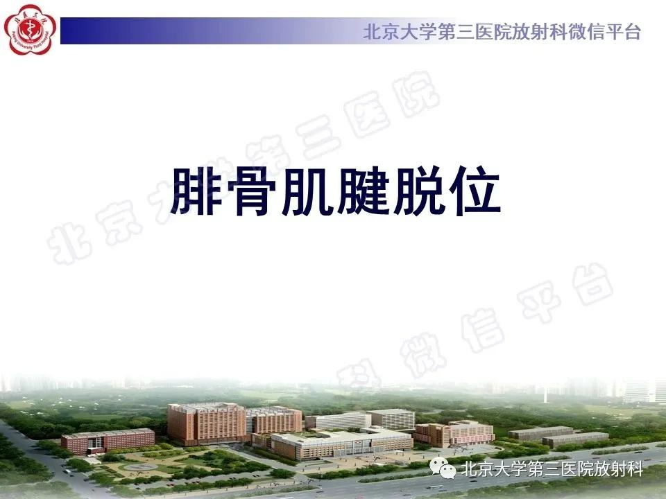 好文分享续集,腓骨肌腱脱位手术价格