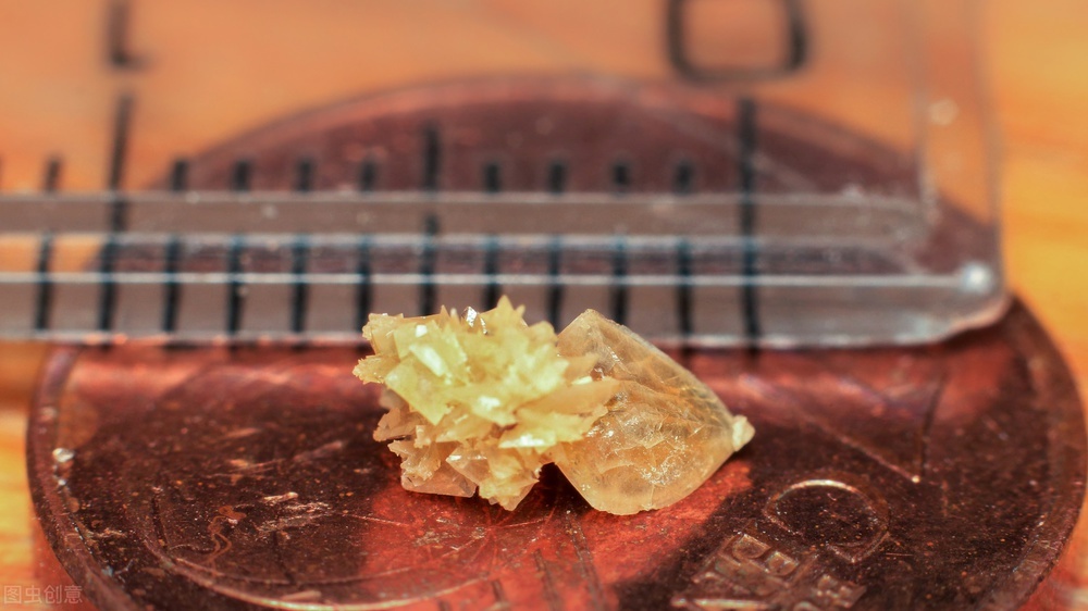 中药肾结石碎石靠谱吗,肾结石通过药物治疗能排掉吗