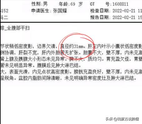 肺癌肝转移一个病灶,肺癌中药调理可以控制住吗