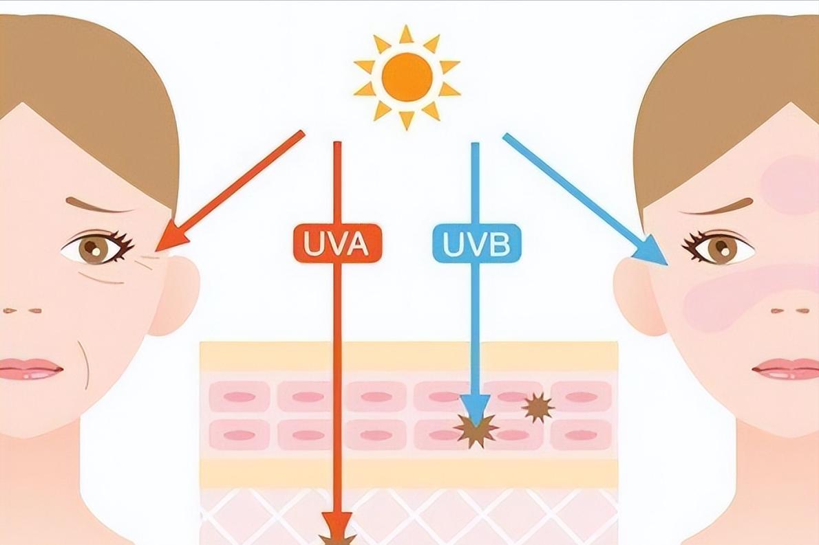 进行光子嫩肤有哪些误区,对光子嫩肤的误区