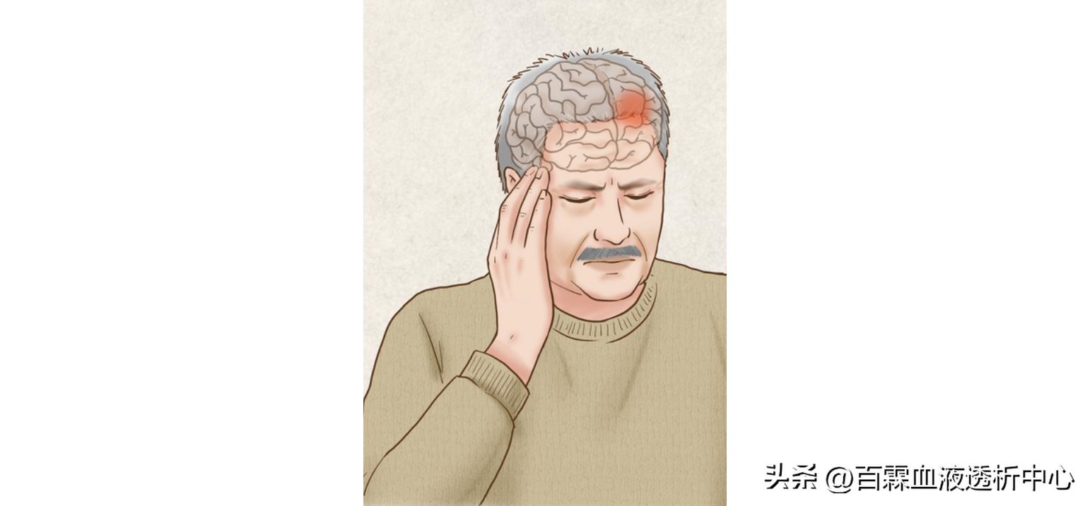 急性脑出血治疗最佳方法中医,急性脑出血患者12小时能吃东西吗