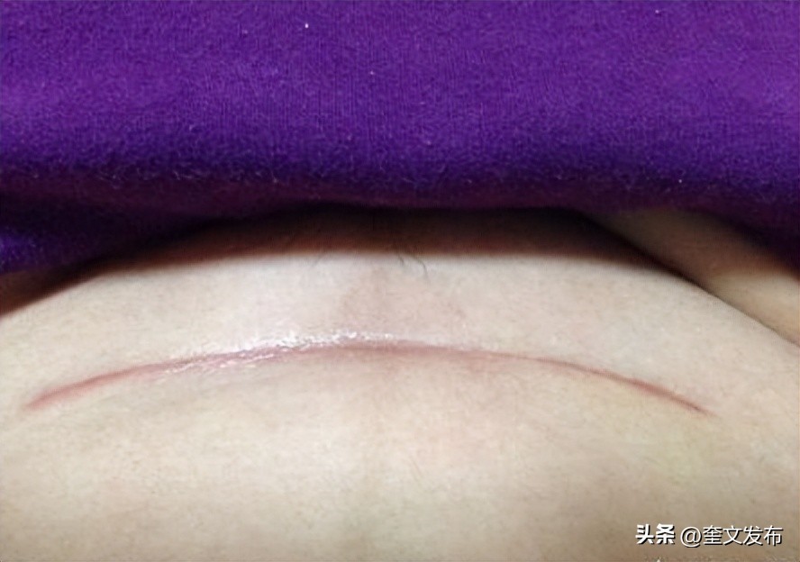 月子常见的28种月子病,坐月子10大禁忌月子病怎么治