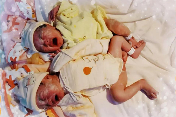 孕产妇艰难分娩,历经保胎艰辛终于儿女双全